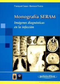 Monografía SERAM